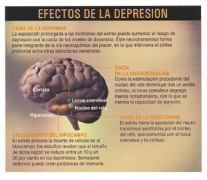 depresión cerebro